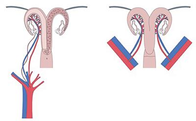 Involving Animal Models in Uterine Transplantation